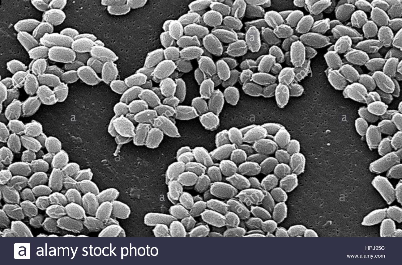 anthrax-bacillus-anthracis-bacteria-sem-HRJ95C.jpg